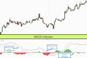 MACD